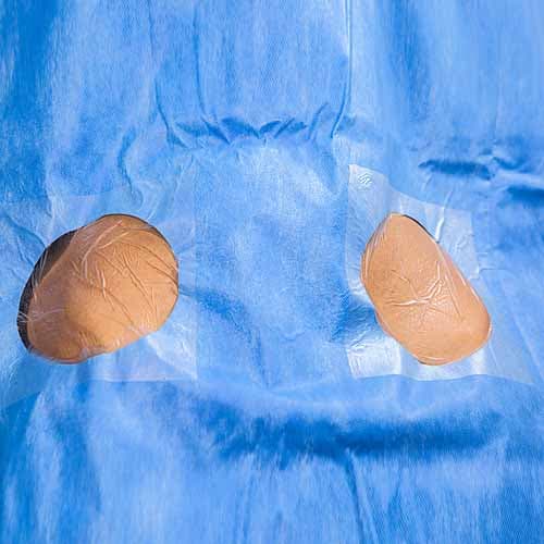 PAÑO QUIRÚRGICO PARA ANGIOGRAFÍA Y ANGIOPLASTIA, 
PAÑOS QUIRÚRGICO PARA MARCAPASOS CARDÍACO